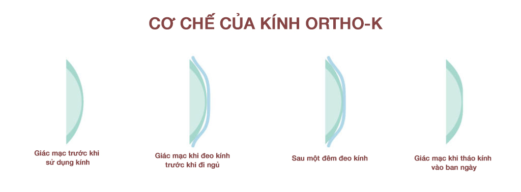 mắt sáng khỏe, khám mắt ngôi sao, mắt sáng