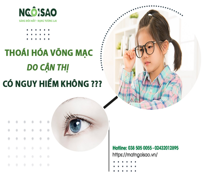 mắt sáng khỏe, khám mắt ngôi sao, mắt sáng