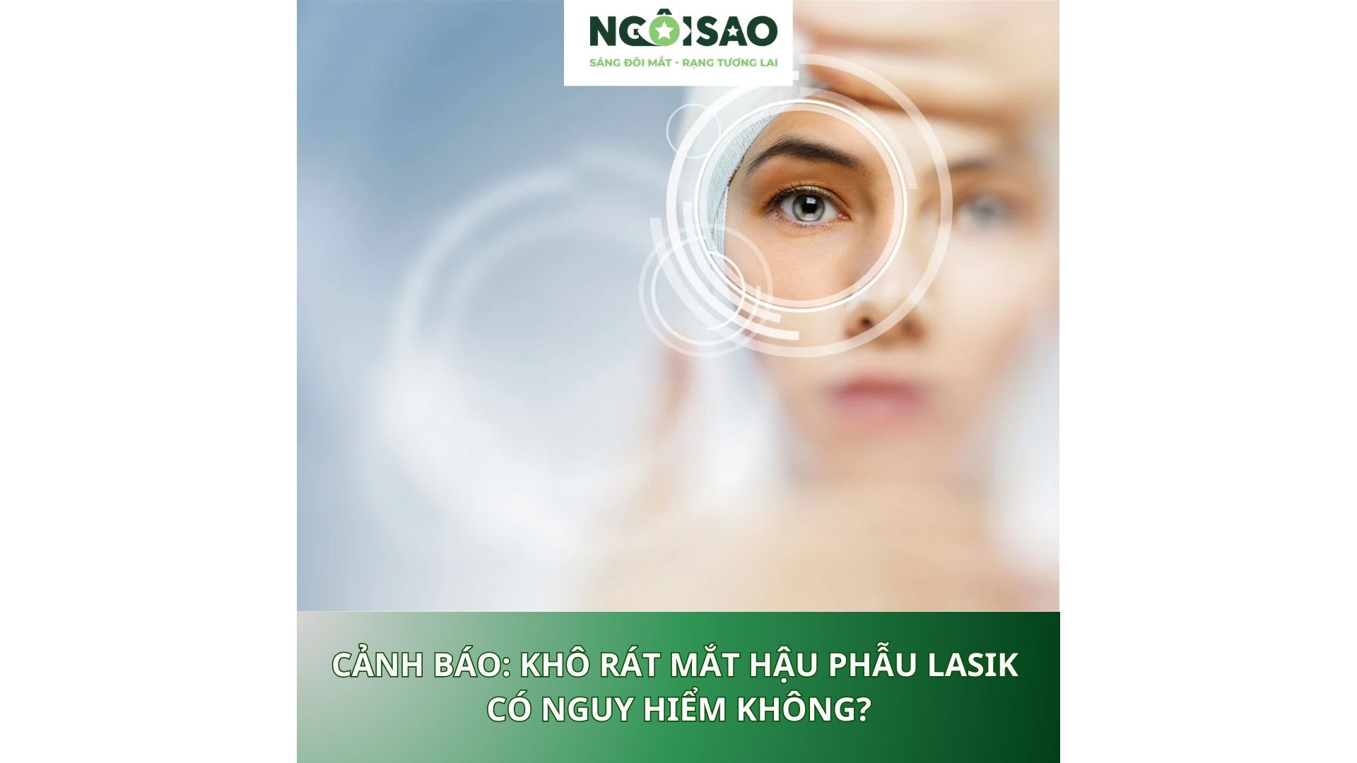 Khô rát mắt hậu phẫu LASIK