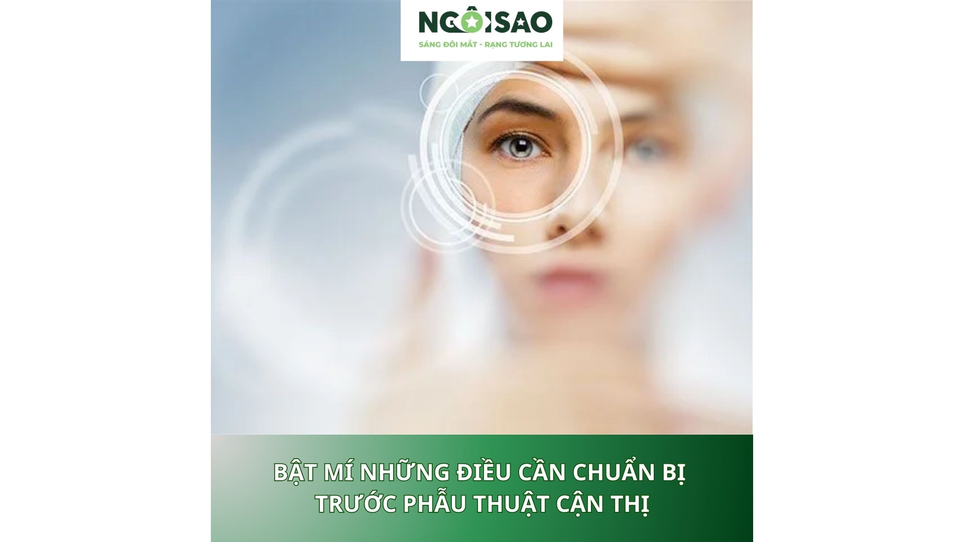 trước phẫu thuật cận thị